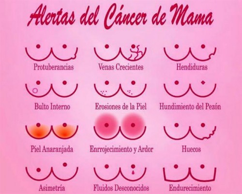 alertas de c�ncer de mama